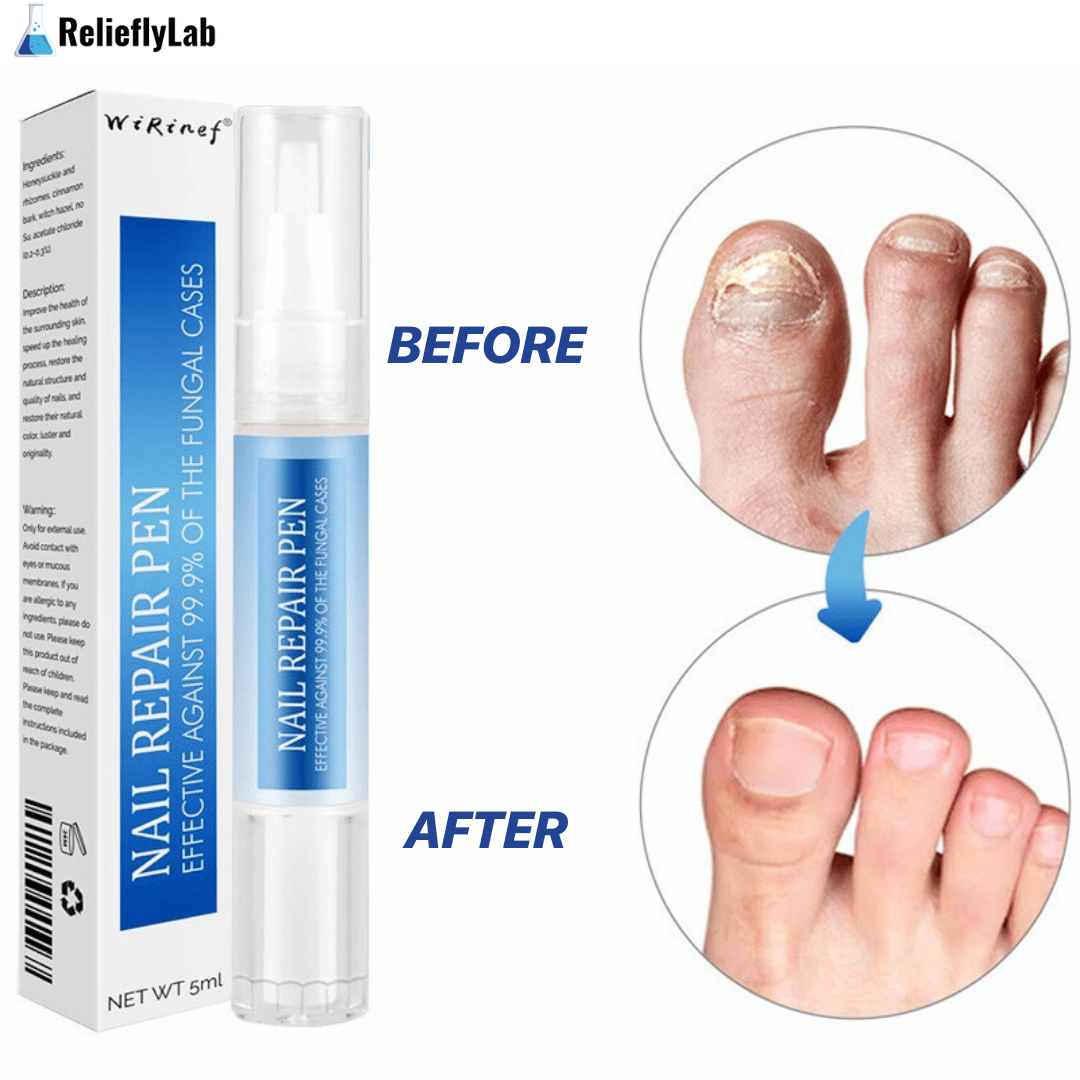RelieflyLab® | Nail Fungus Pen