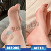 RelieflyLab® | EMS Foot Massager