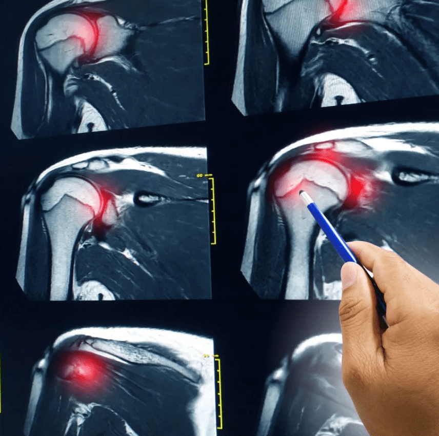 RelieflyLab | 3 In 1 Shoulder Device 13 Screenshot 2023 10 11 alle 19.30.18 min 1