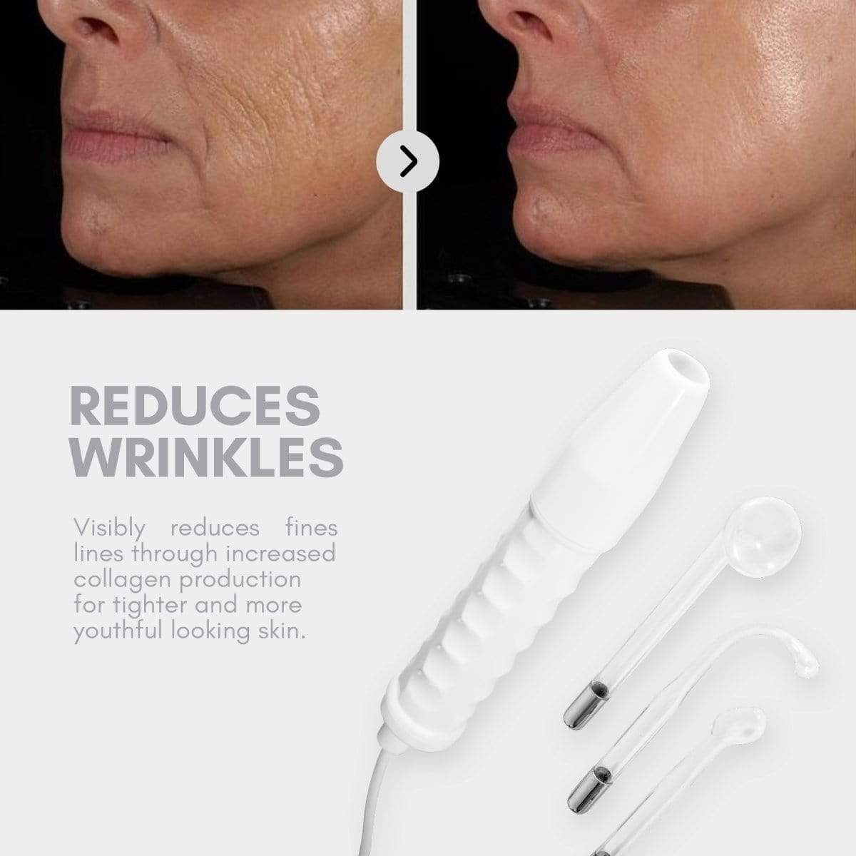 RelieflyLab® | High Frequency Therapy
