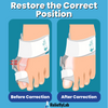 Load image into Gallery viewer, RelieflyLab™ | Bunions Corrector