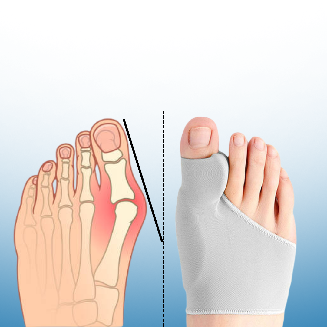 RelieflyLab™ Bunions Correct Set
